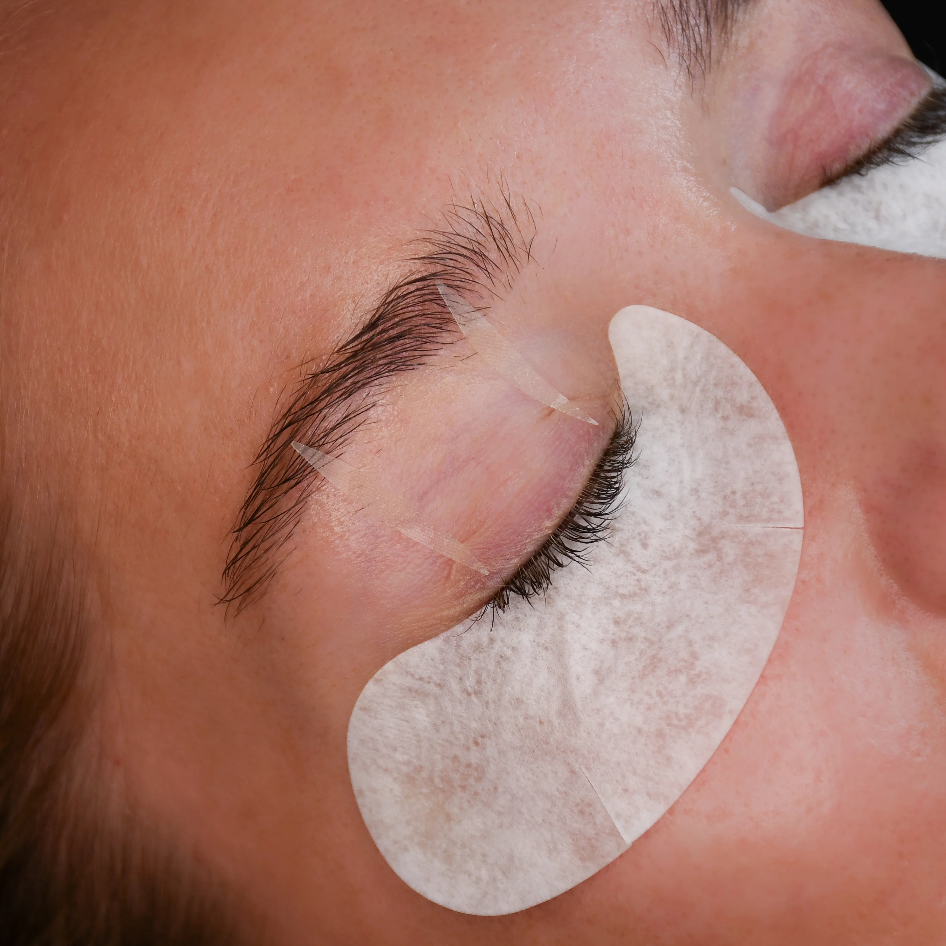 Eyelid Tape - Image 3