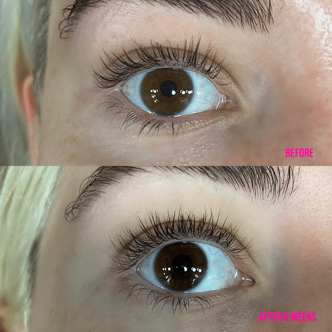 Lash Treatment Serum - Image 3